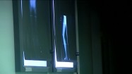 Zdjęcie rentgenowskie nogi