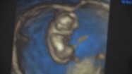Obraz 3D ludzkiego zarodka