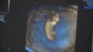 Obraz 3D ludzkiego zarodka