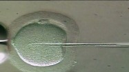 Zapłodnienie in vitro pod mikroskopem