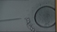 Zapłodnienie in vitro pod mikroskopem