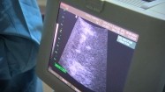 Zapłodnienie in vitro - obraz na monitorze