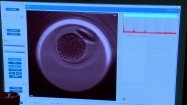 Etapy zapłodnienia in vitro na monitorze