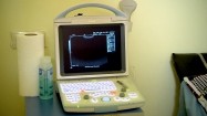 Ultrasonograf